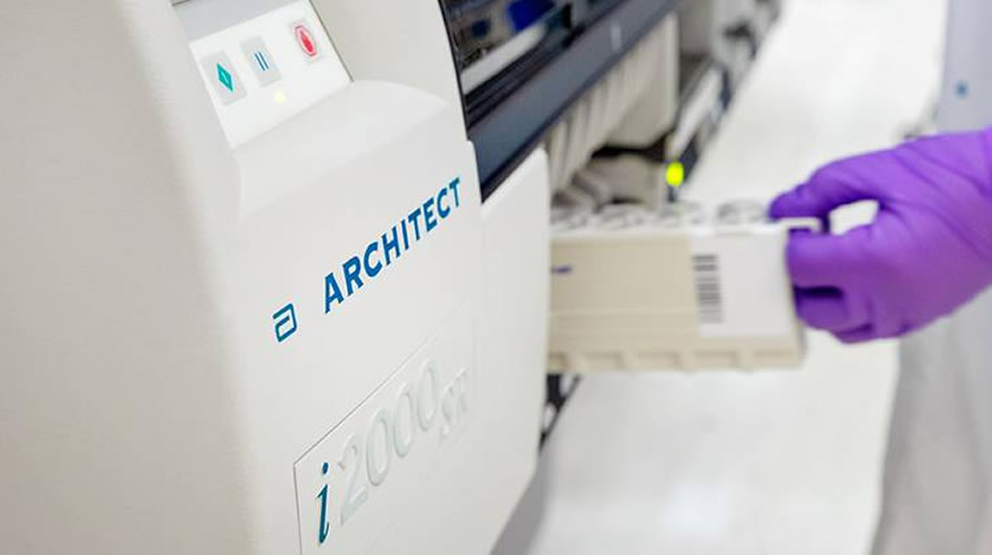 Alliar (AALR3) inicia testes para Covid-19 com 99,5% de precisão