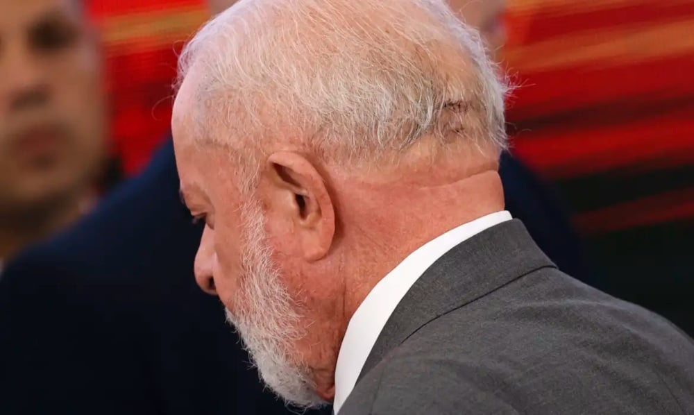 Lula passará por mais uma cirurgia para evitar novos sangramentos cerebrais