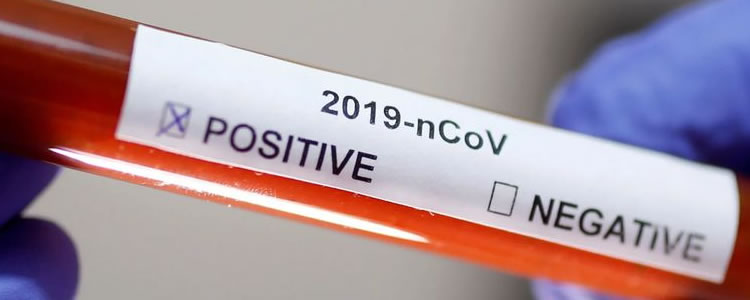 Coreia do Sul: pacientes considerados recuperados testam positivo novamente para Covid-19